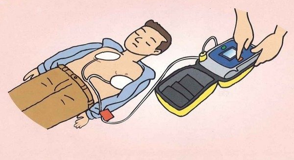 aed
