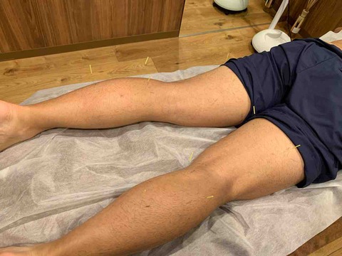 A4779DC1-8F36-45FF-B8CF-E3E6FCFE4FE4