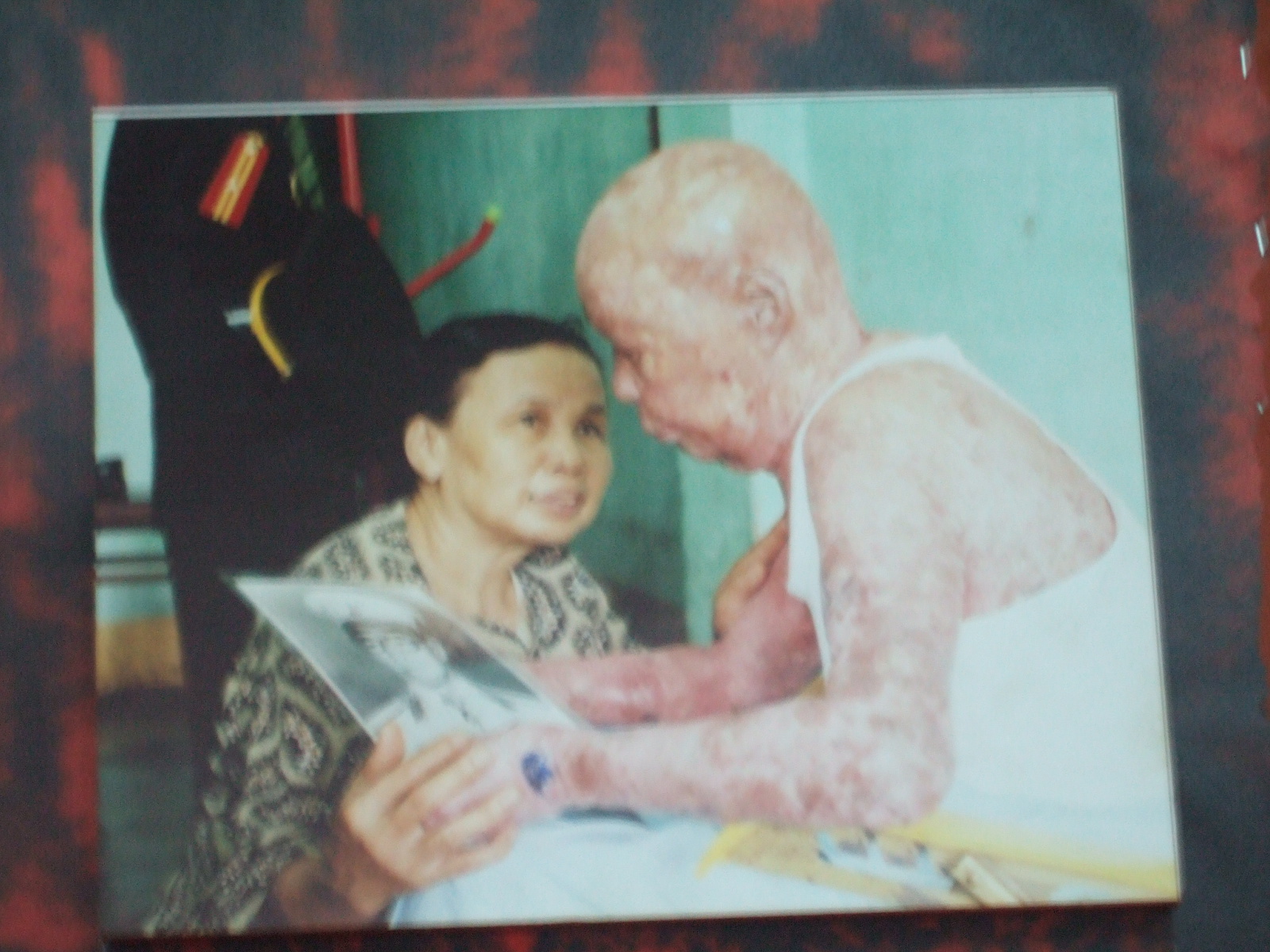 ホーチミン戦争博物館 写真１７ 後遺症２ このシリーズは 心の準備をしてから見て下さい パルマローザ店長日記