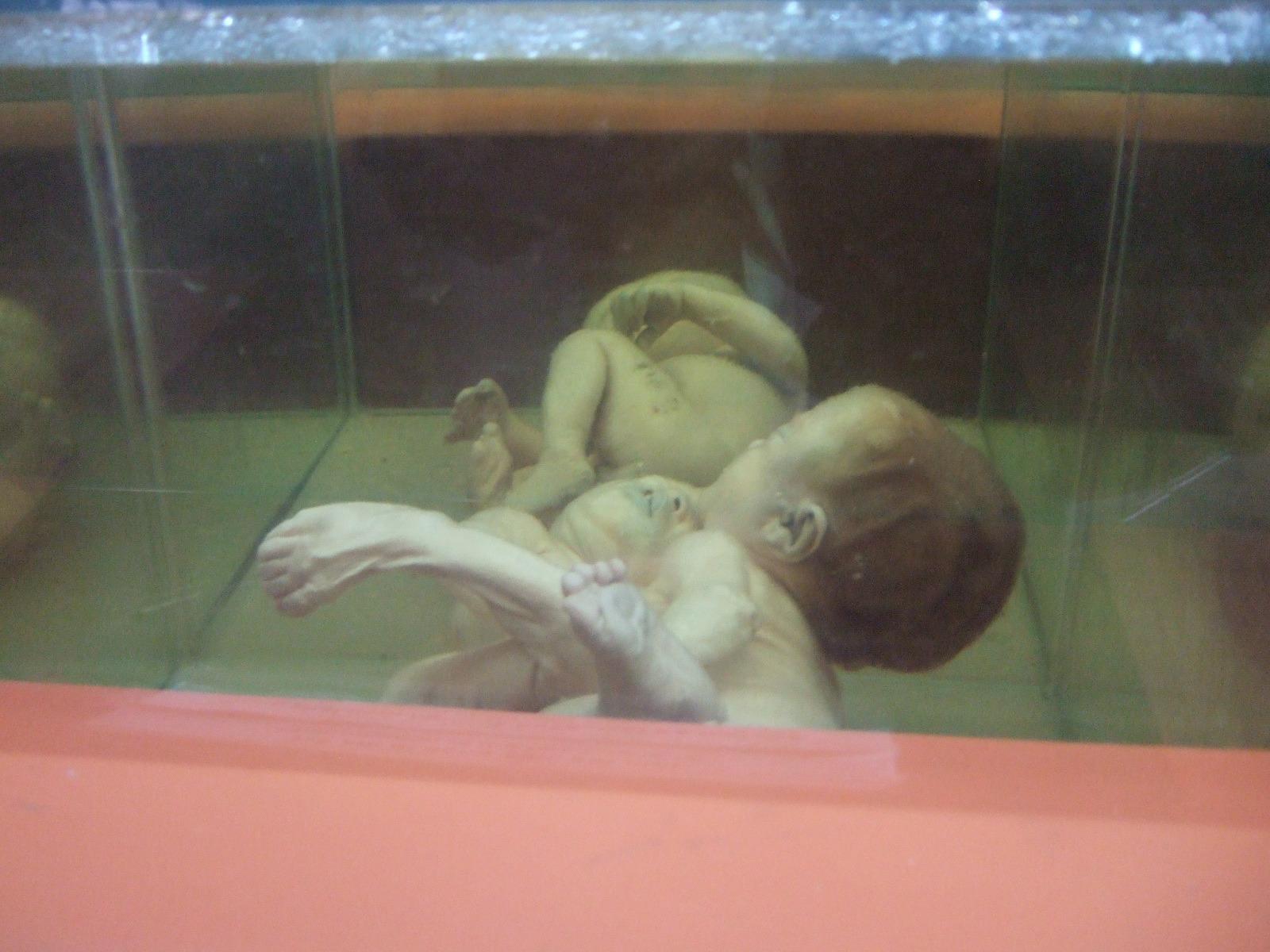 ホーチミン戦争博物館 写真２０ 水槽の中 １ このシリーズは 心の準備をしてから見て下さい パルマローザ店長日記