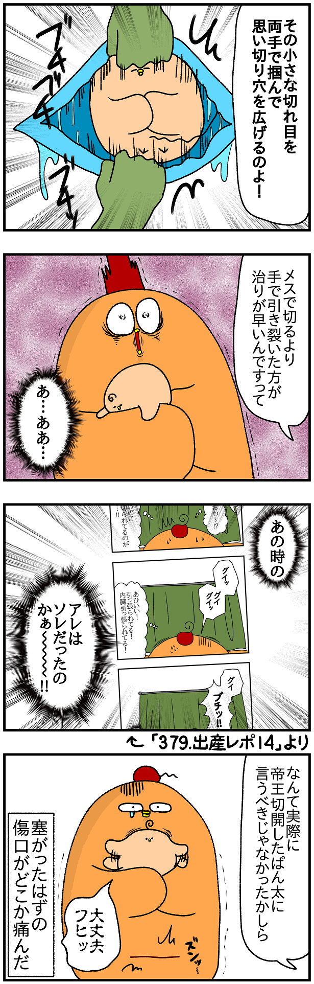 442 帝王切開のテクニック ぱんをたずねて2000里ちょい