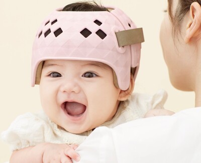 赤ちゃんのヘルメット治療