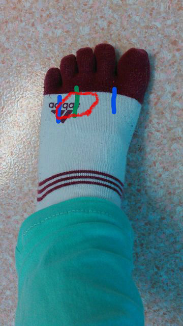 足の甲の痛み 横浜市中区元町の整体 カイロプラクティックcura クーラ パパクーラの世界 足の甲の痛み 横浜市中区元町の整体 カイロプラクティックcura クーラ パパクーラの世界