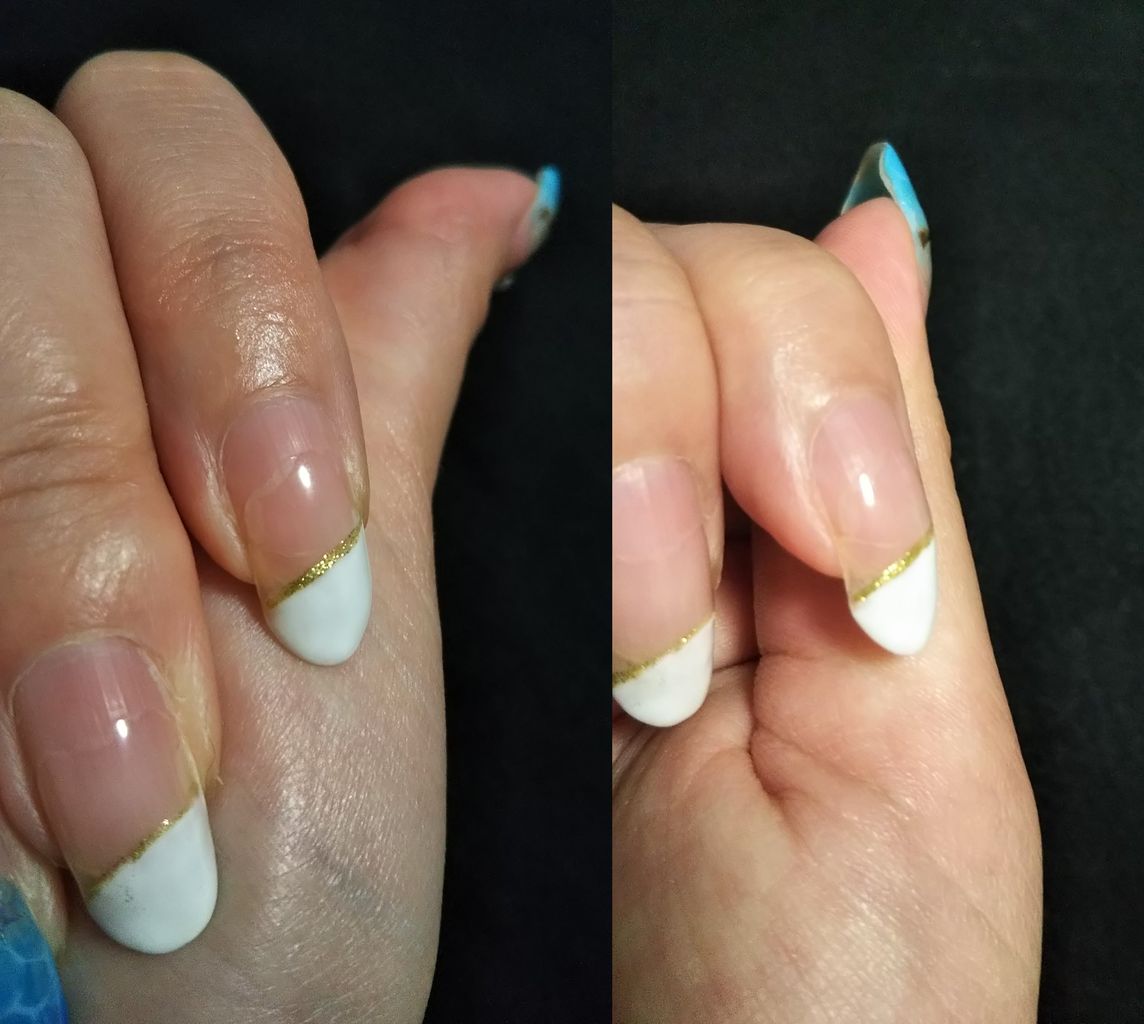 ストレスポイントからのヒビ 私の歩む道 ストレスポイントからのヒビ 私の歩む道