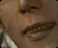 drん