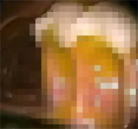 �ơ��ץ�������