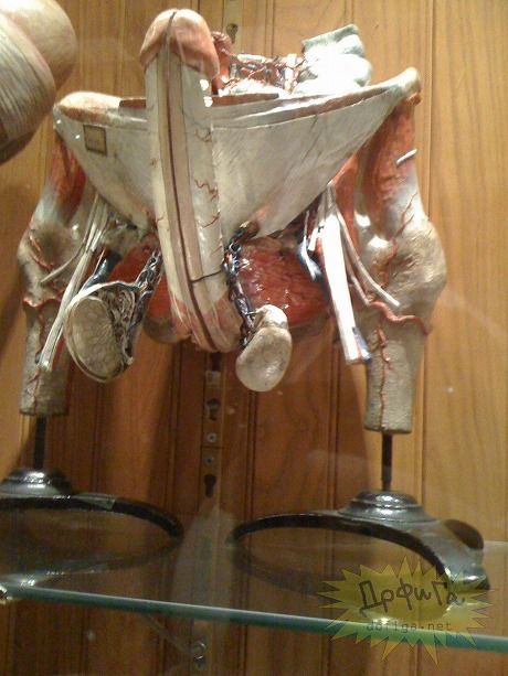 人体標本 ロボトミー手術の道具の展示で知られている ムター博物館 の展示物 アメリカ ザイーガ