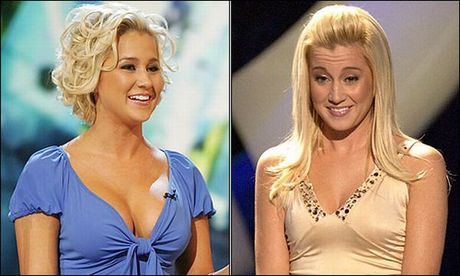 celebrities_before_and_after_boob_jobs_15