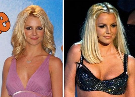 celebrities_before_and_after_boob_jobs_05