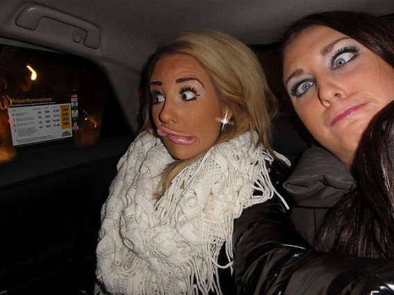 swedish_blonde_has_a_dozen_plastic_surgeries_640_12