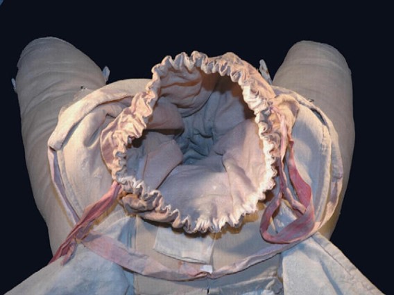 2_e6