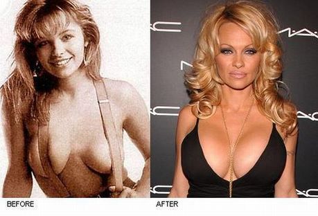 celebrities_before_and_after_boob_jobs_03