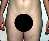 体