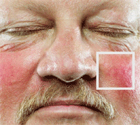 �ल�����