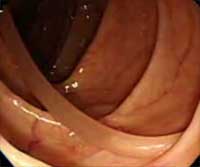 ��������