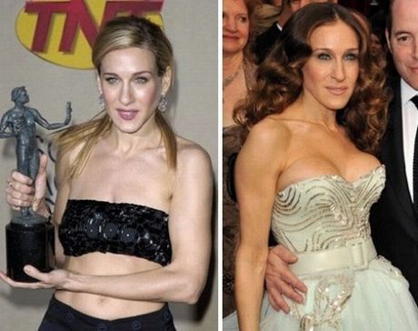 celebrities_before_and_after_boob_jobs_16