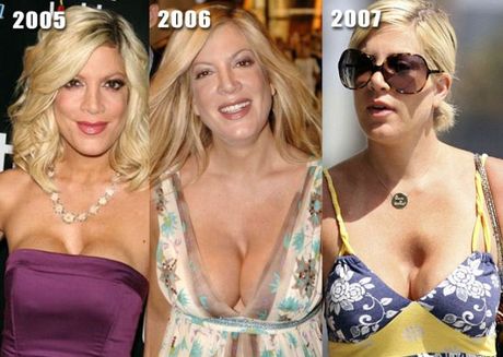 celebrities_before_and_after_boob_jobs_18