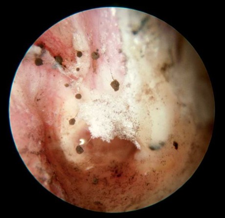 inside-womans-ear