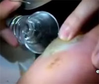 ¤×¤Á¤Ë¤å¡¼¤ë