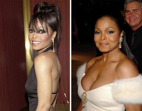 celebrities_before_and_after_boob_jobs_12