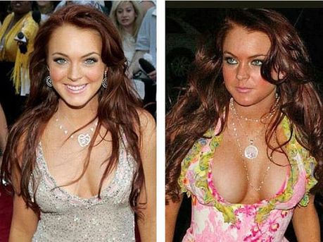 celebrities_before_and_after_boob_jobs_04