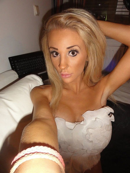 swedish_blonde_has_a_dozen_plastic_surgeries_640_02