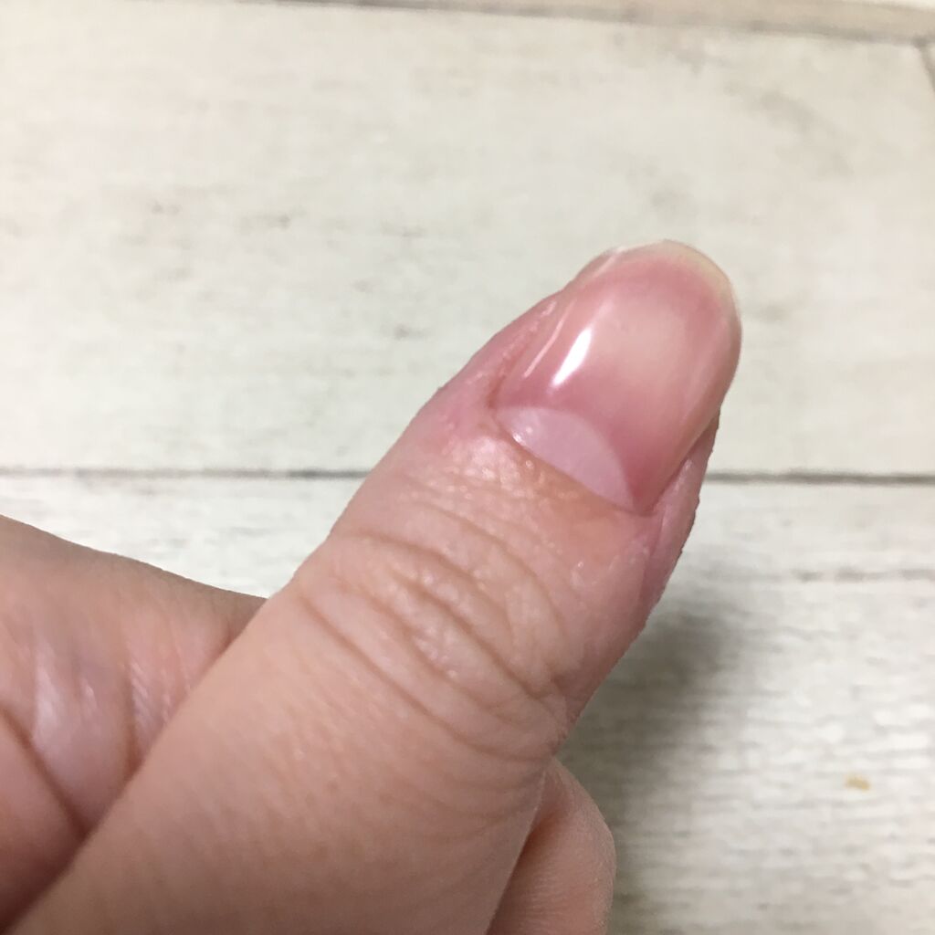 どうしてもやめられない癖 予防策 こんな女の Powered By ライブドアブログ どうしてもやめられない癖 予防策 こんな女の Powered By ライブドアブログ