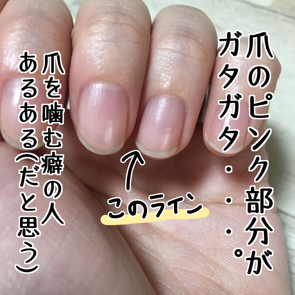 どうしてもやめられない癖 指の皮をむしってしまう こんな女の Powered By ライブドアブログ どうしてもやめられない癖 指の皮をむしってしまう こんな女の Powered By ライブドアブログ
