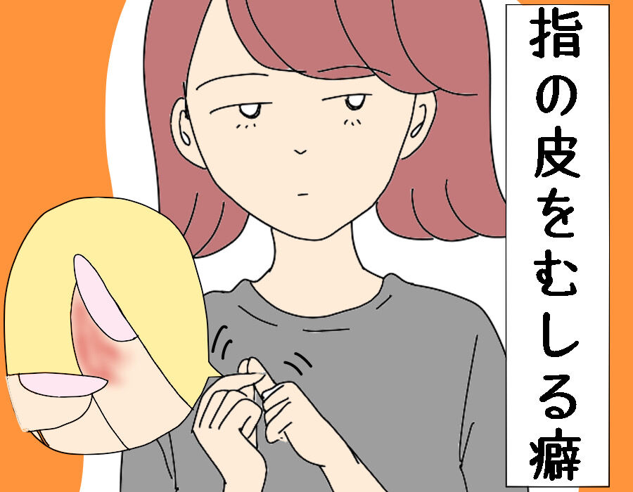 どうしてもやめられない癖 指の皮をむしってしまう こんな女の Powered By ライブドアブログ どうしてもやめられない癖 指の皮をむしってしまう こんな女の Powered By ライブドアブログ