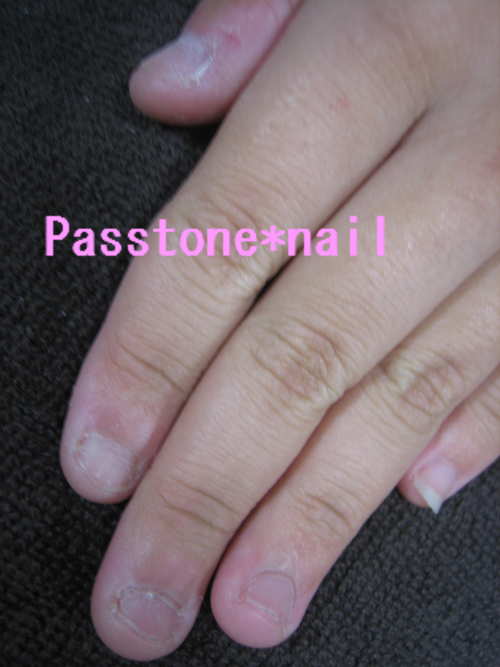 深爪 パストーンネイル フットのブログ
