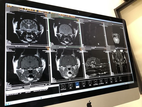 MRI