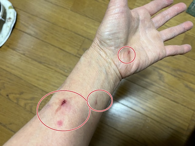 怪我