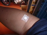血液検査131003