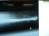 20110203の骨 (1)