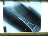 20110203の骨