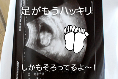 たまご日記 -はじめての妊娠&子育て-