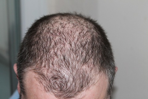 hair-248050_1920
