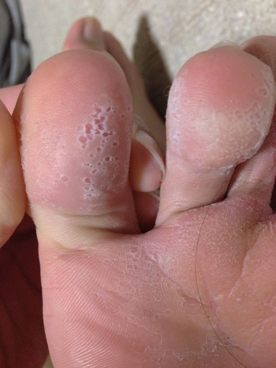 マラニック速報 画像 足の裏きめぇwwwwwwwww