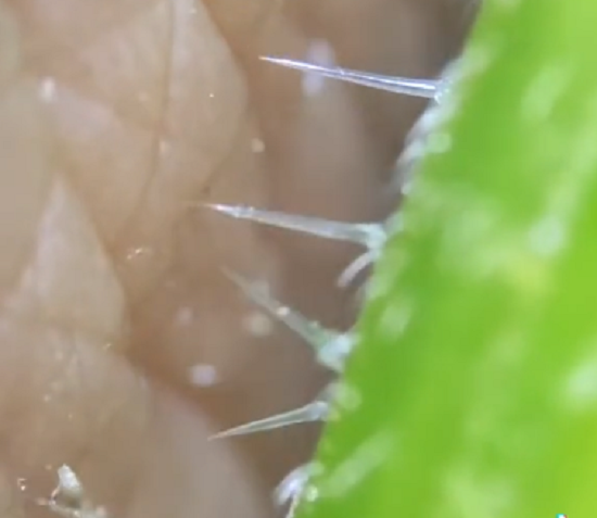 植物の小さなトゲが皮膚に刺さるようすを顕微鏡で観察！　見てて痒くなってくるｗ