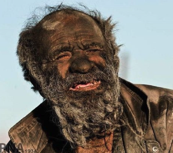 「世界で最も汚い男」が67年ぶりに風呂に入ったことで死亡した！？（2枚の写真とビデオ）　