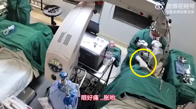 中国の医師が手術中に82歳の患者をド突き失明させた！？