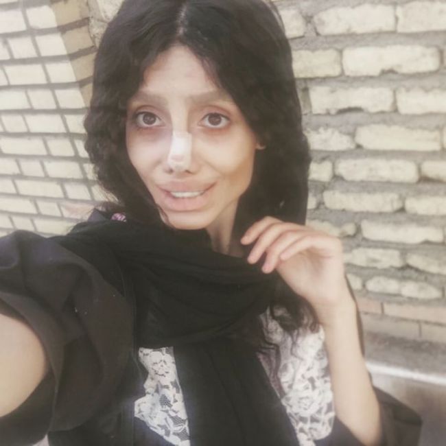 アンジェリーナ ジョリーに似たくて50回の手術をしたイラン人女性をご覧ください 12枚の写真 夜ふかしのすすめ