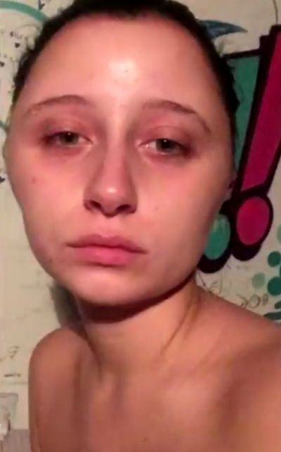 allergy_hair_dye_03