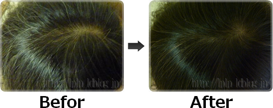 LPLP白髪染め実践結果