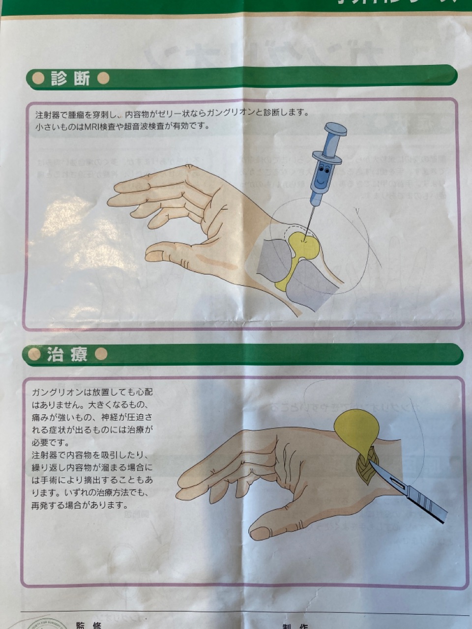 ガングリオンてなんですか 猫の手貸して Powered By ライブドアブログ