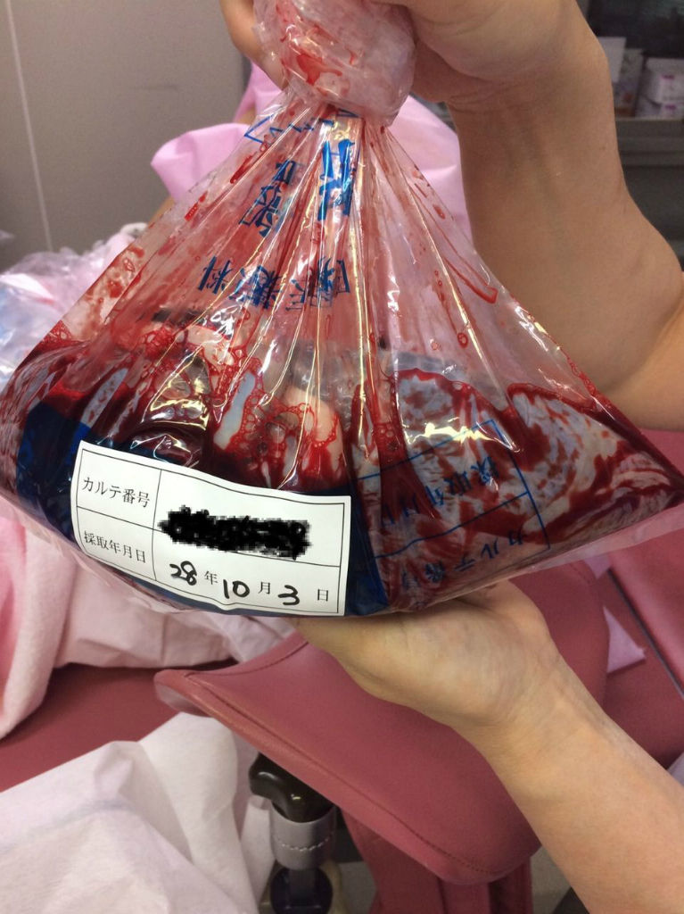 出産レポ 胎盤写っているので閲覧注意です ぴよぴよくらし 出産レポ 胎盤写っているので閲覧注意です ぴよぴよくらし