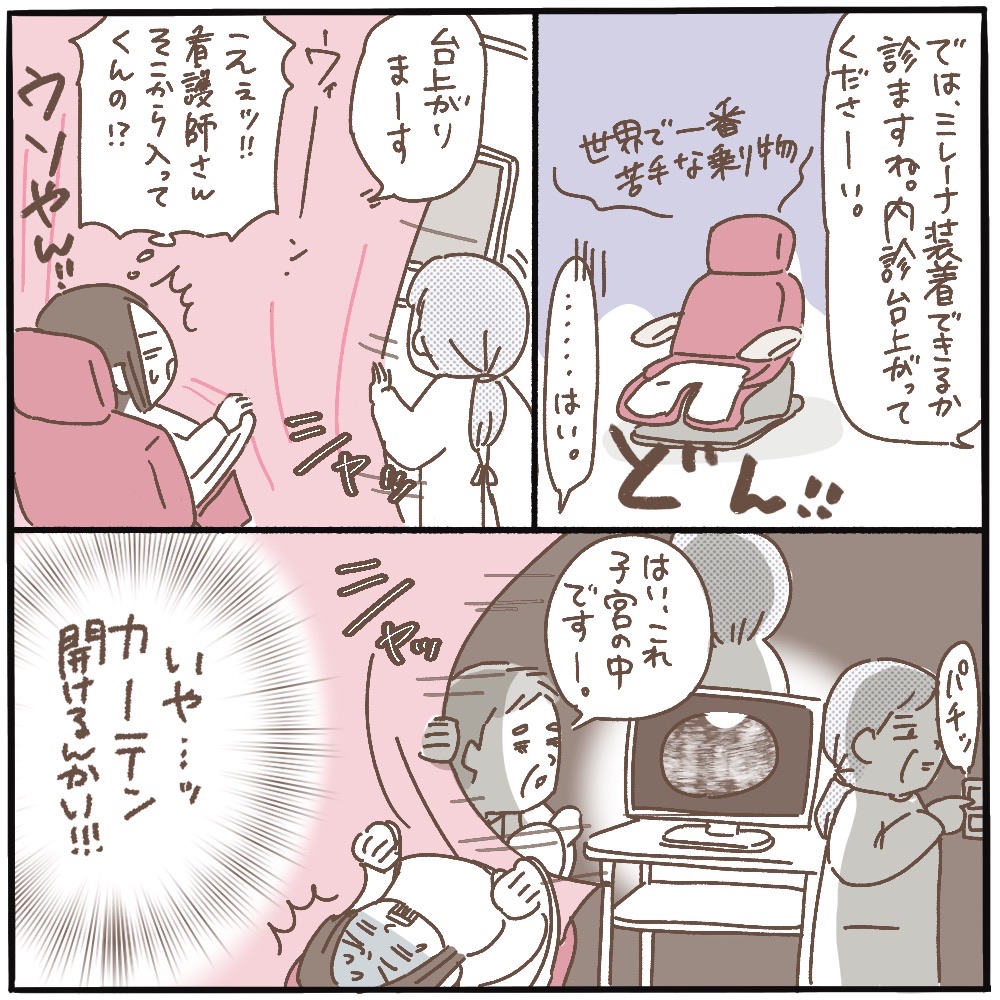 ミレーナ 体験 談