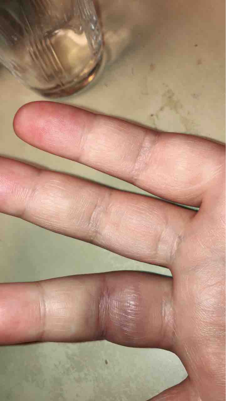 転倒(u003e_u003c))))!! : 楽器大好き!