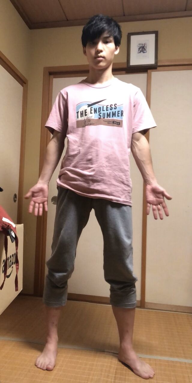 画像 身長167cmのドチビさんが骨延長手術を受けてみた結果wwwwwwwww 画像 身長167cmのドチビさんが骨延長手術を受けてみた結果wwwwwwwww