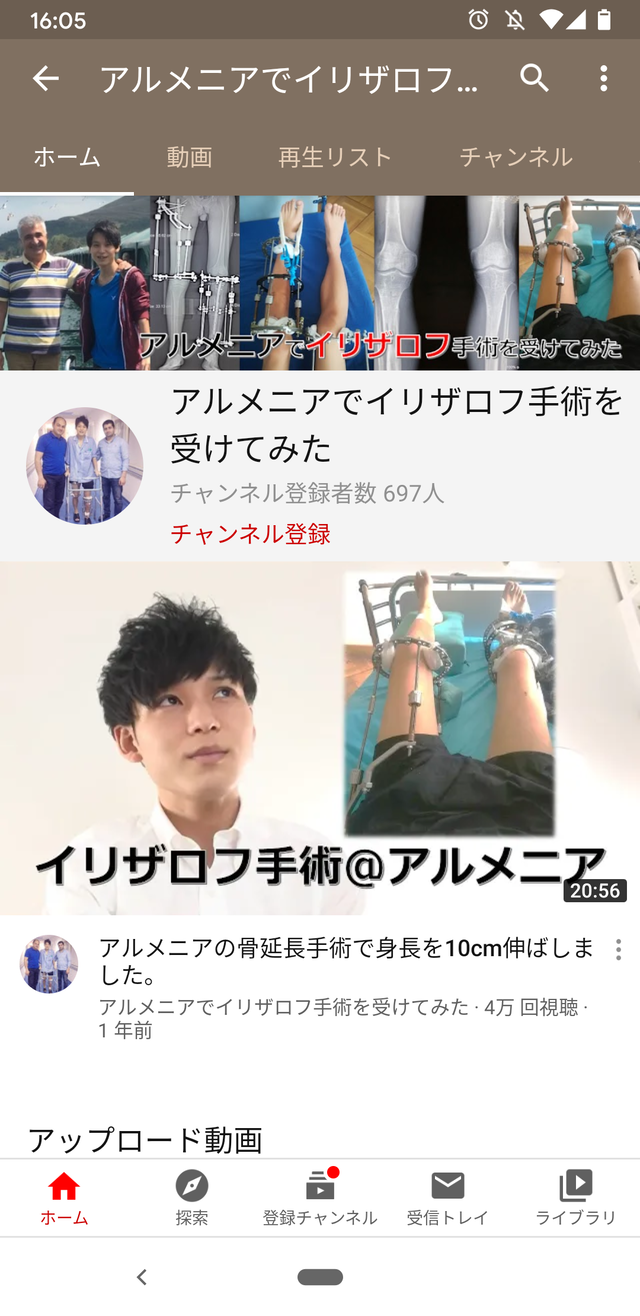 画像 身長167cmのドチビさんが骨延長手術を受けてみた結果wwwwwwwww 画像 身長167cmのドチビさんが骨延長手術を受けてみた結果wwwwwwwww